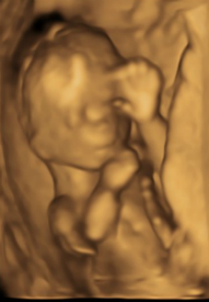 17 weeks 3D Image