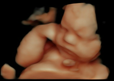 30 weeks 3D HD Live Image